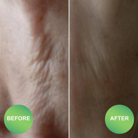 Marine Collagen Peptides
